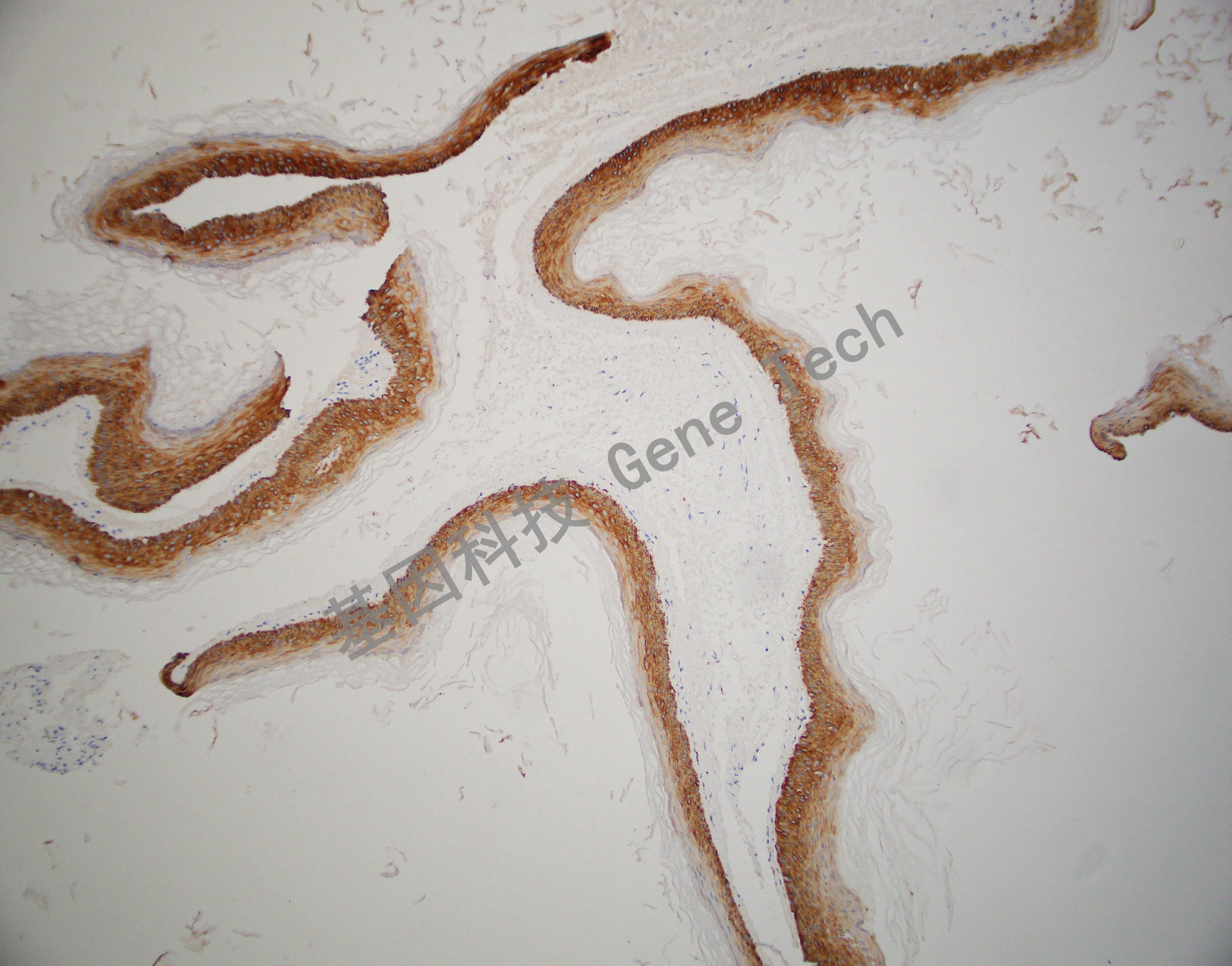 CK14   BE13 皮肤 20201111-7 BE13 -3_副本.jpg