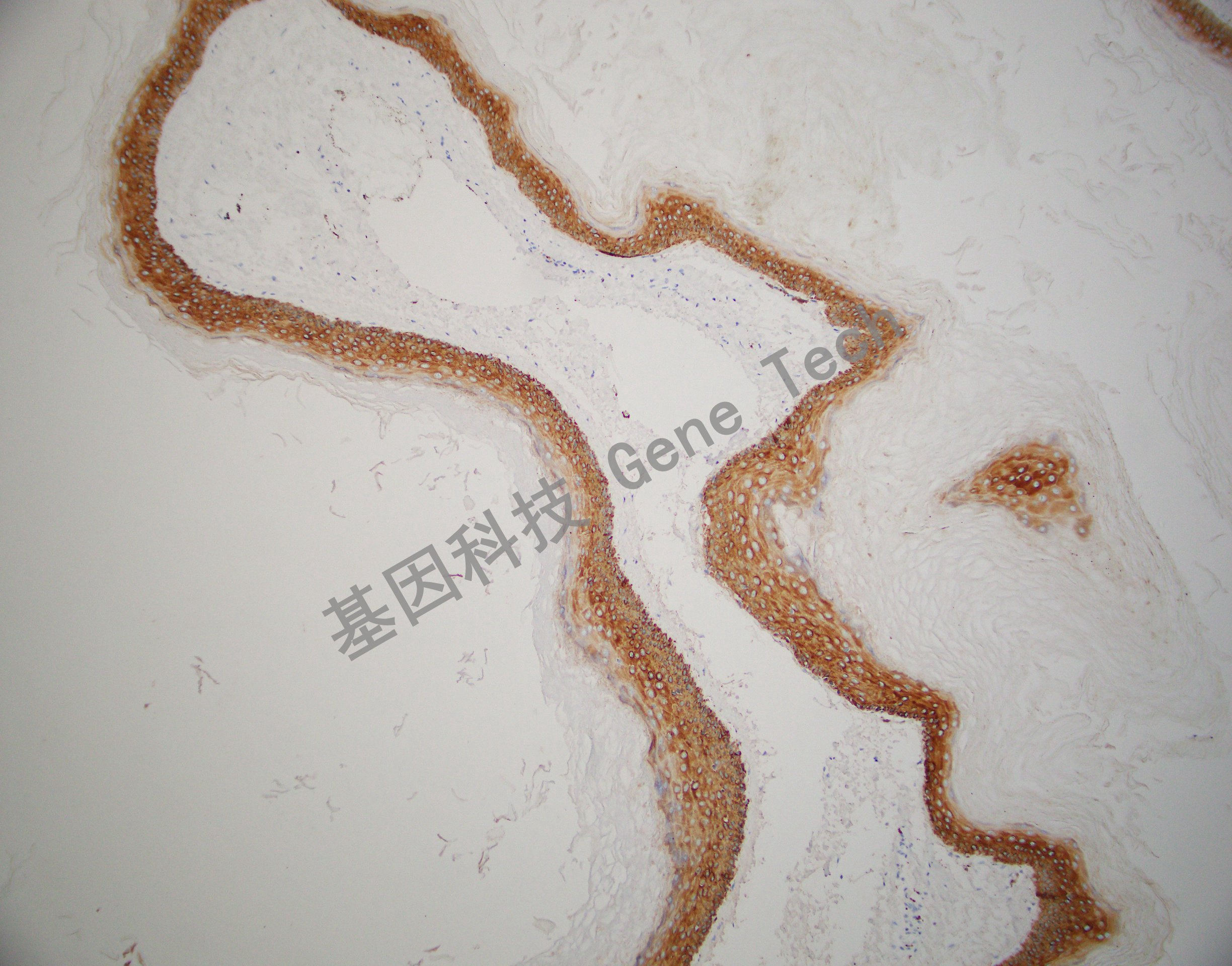 CK14  BE13 皮肤 20201111-7  -1_副本.jpg