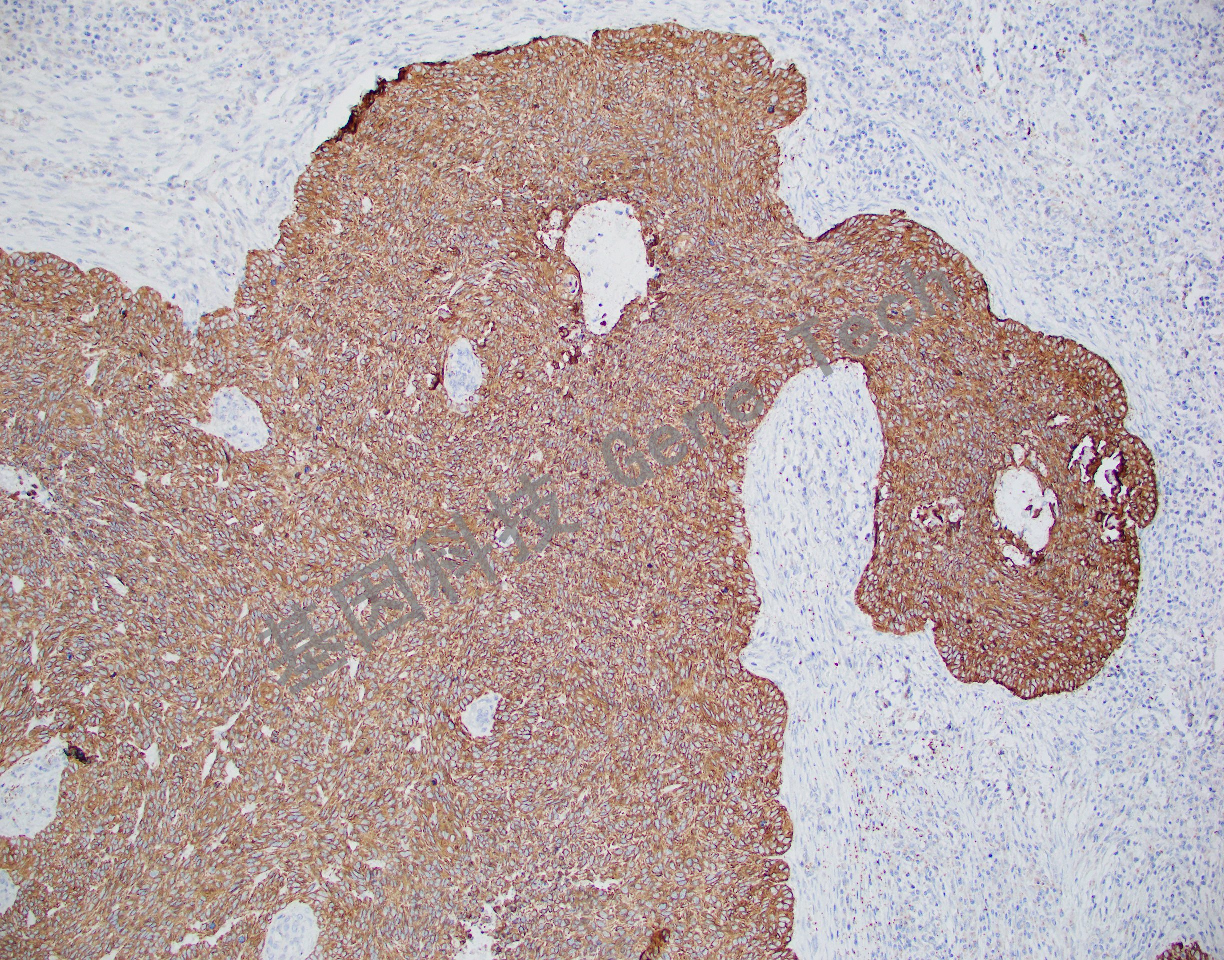 CK17 BE2 皮肤  20201217-13 -4_副本.jpg