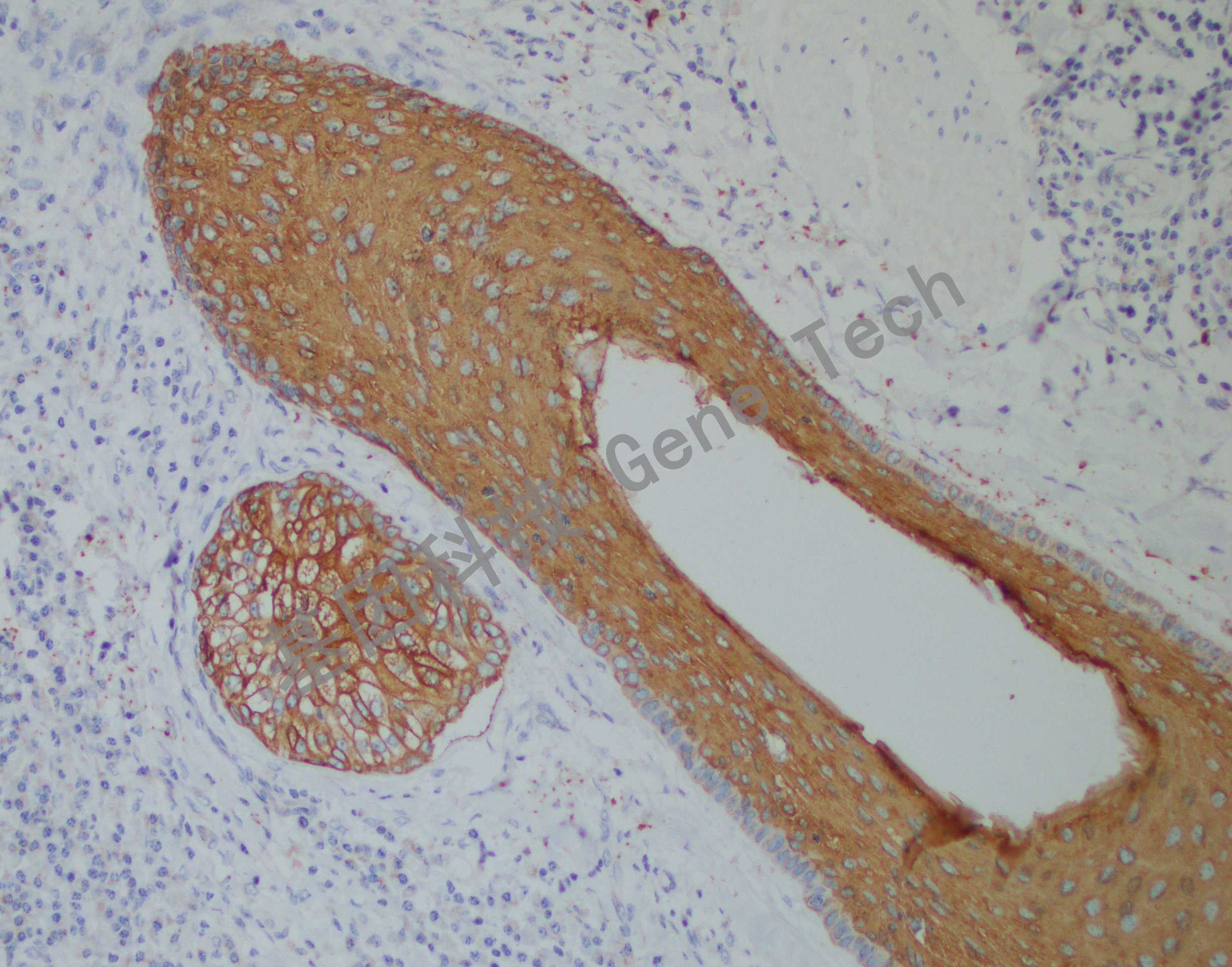 CK17 BE2 皮肤 20201217-13 BE2 -5 20X -2_副本.jpg