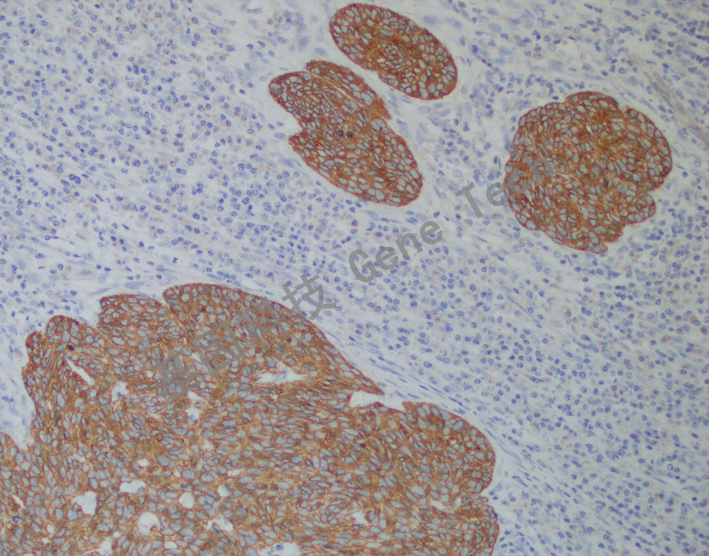 CK17 BE2 皮肤 20201217-13 BE2 -5 20X_副本.jpg