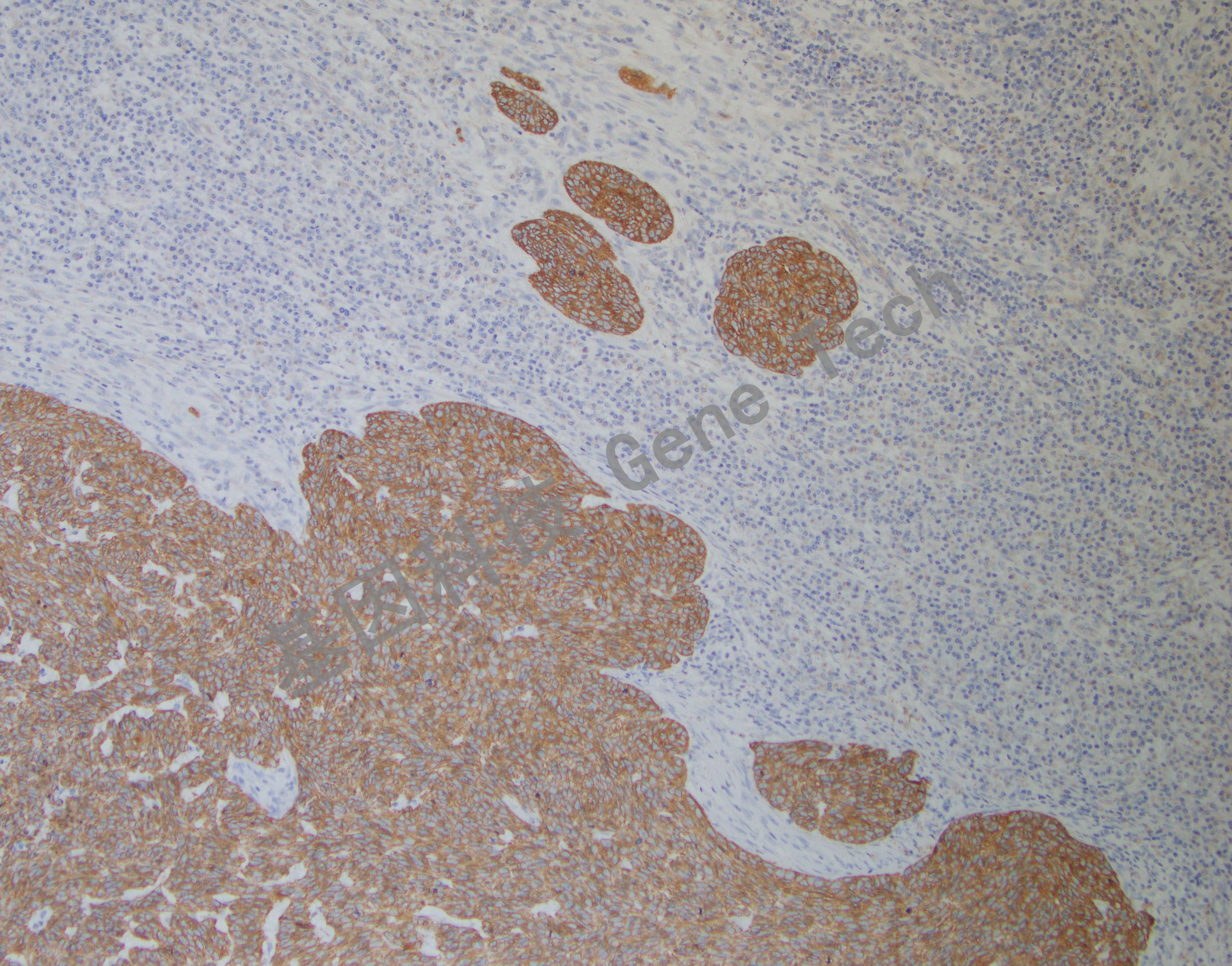 CK17 BE2 皮肤 20201217-13 BE2 -5_副本.jpg