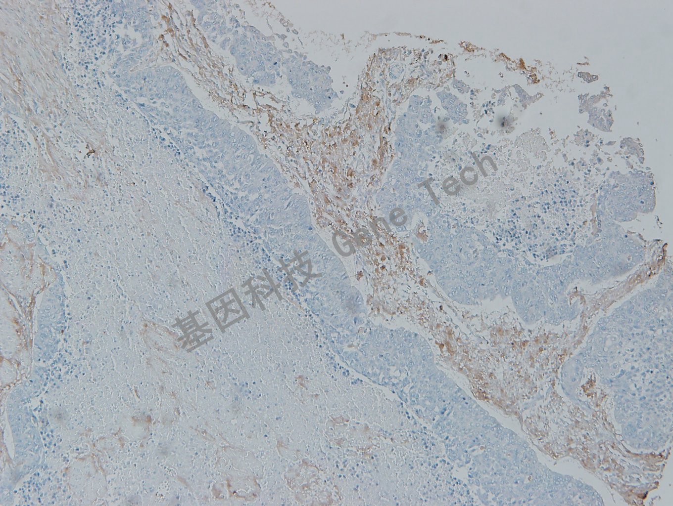 20200302-23 Collagen 06-T4 膀胱2_副本.jpg