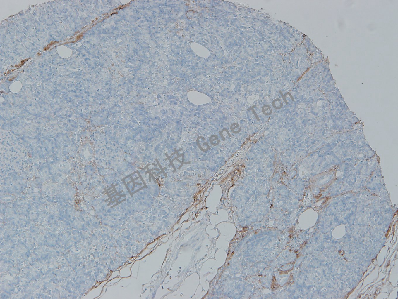 20200302-23 Collagen 06-T4 胰腺_副本.jpg