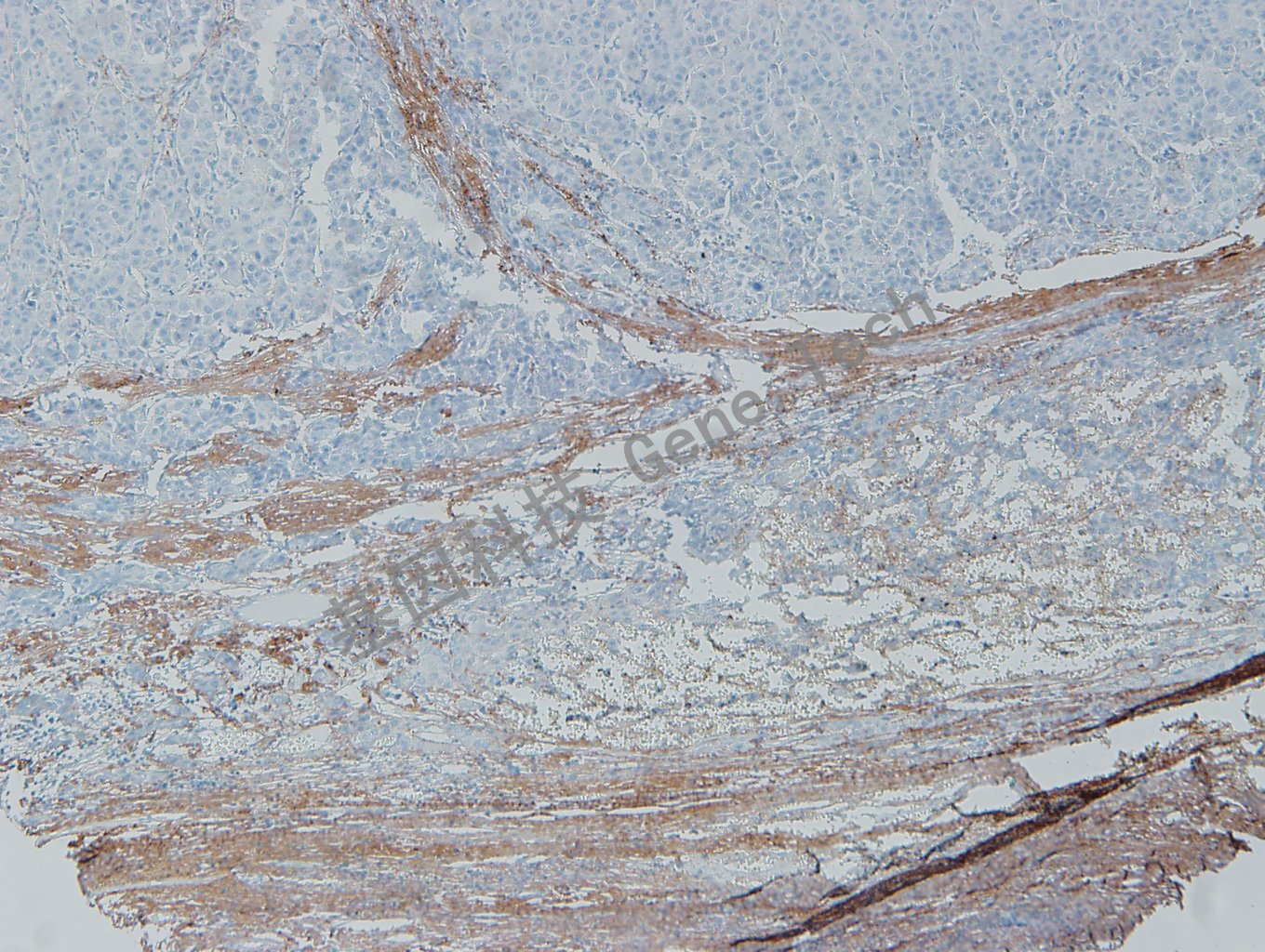 20200302-24 Collagen 06-T4  肝_副本.jpg