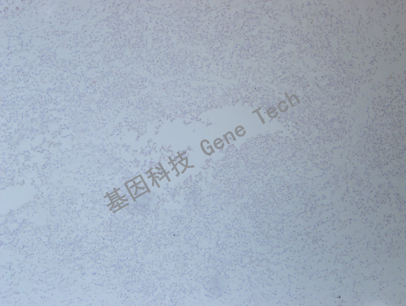 1626751497901429.jpg 20200902-47 FOSB C82 乳腺炎_副本.jpg