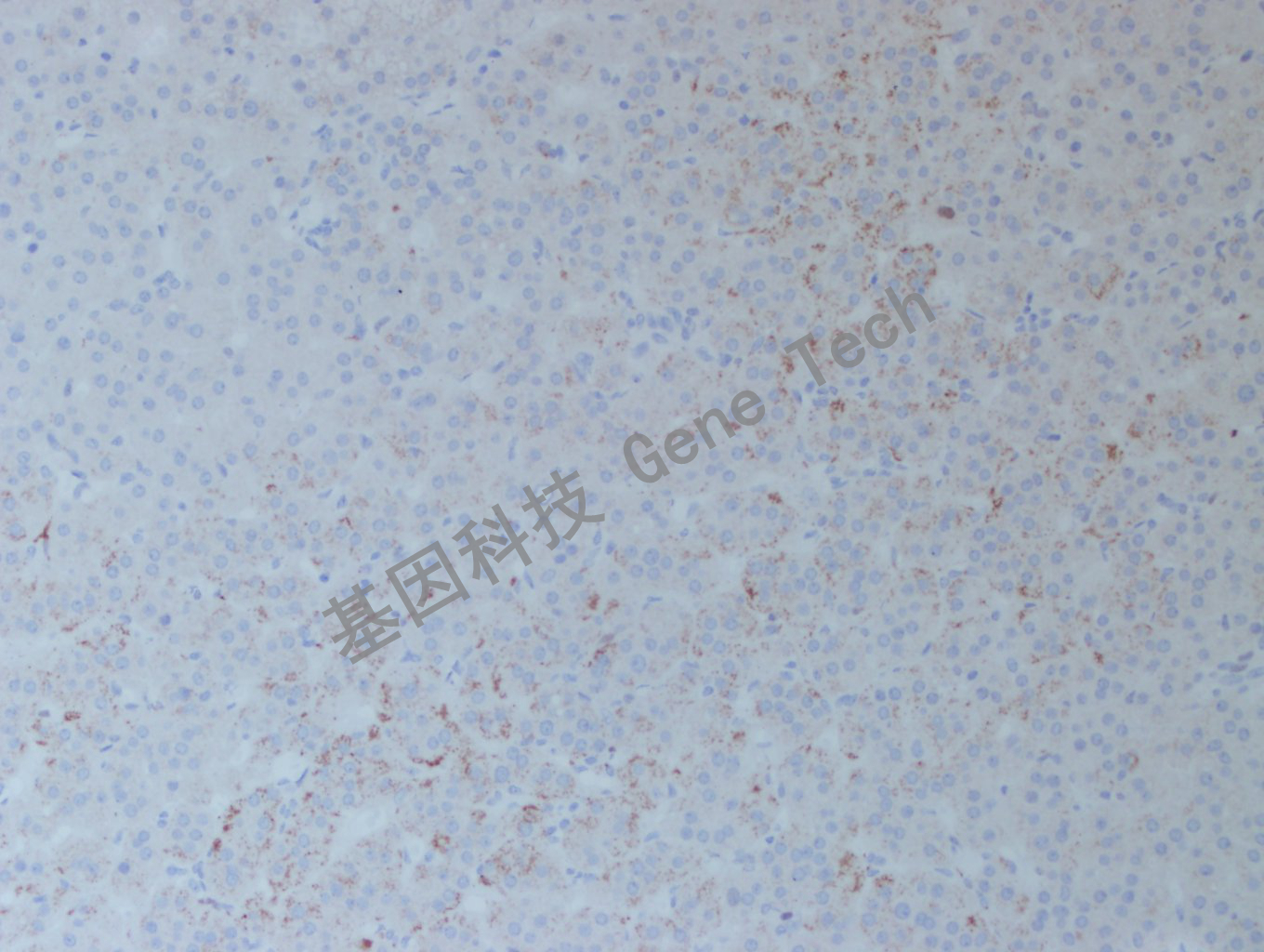 20200902-48  FOSB BN3  肾上腺嗜铬细胞瘤-2_副本.jpg