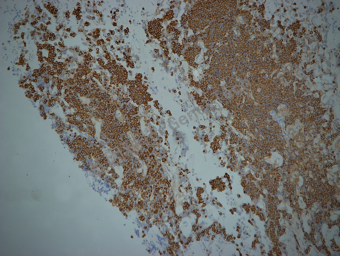 Tubulinβ3 GT2168 垂体腺瘤_副本.jpg