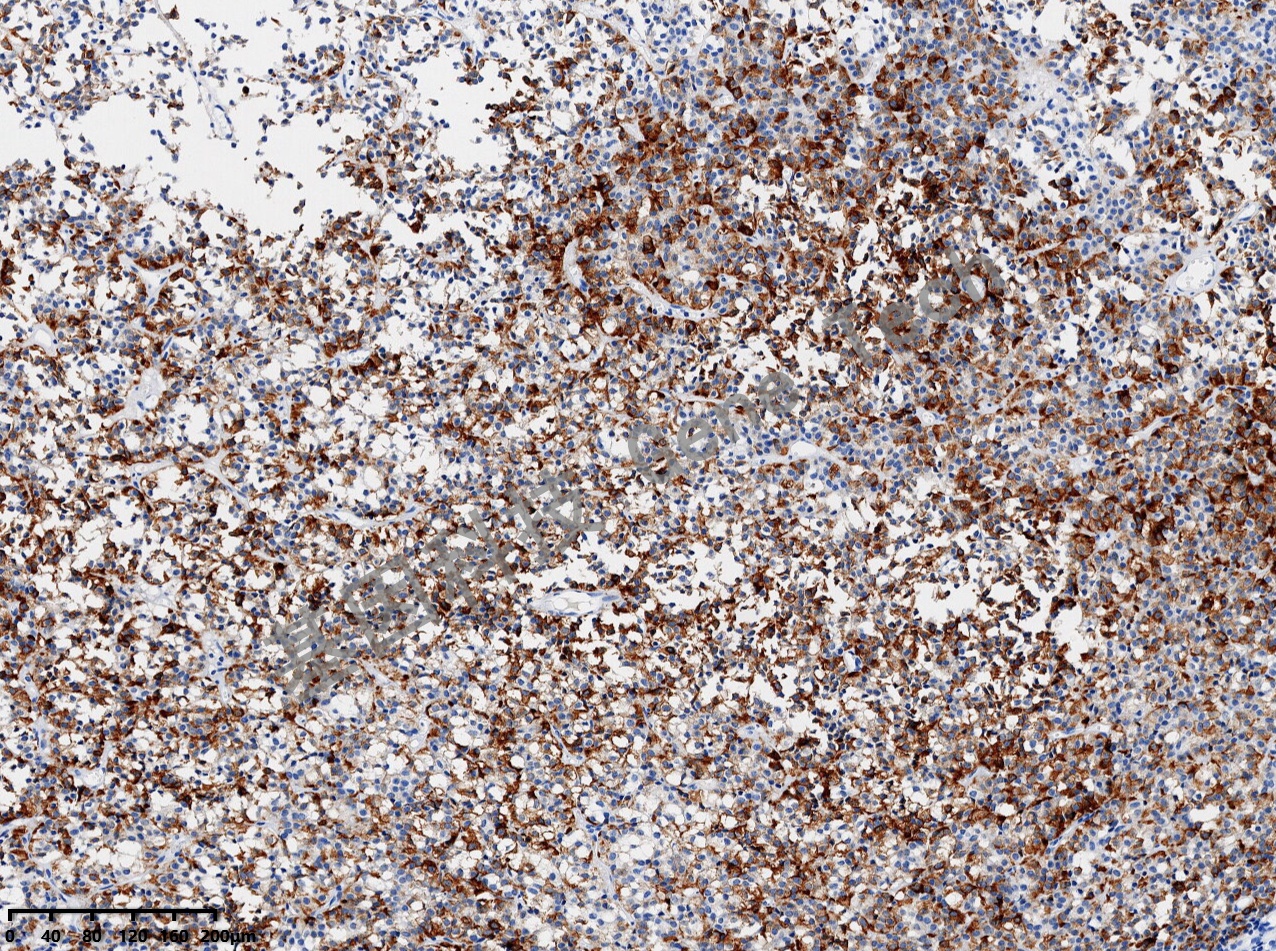 TSH 垂体瘤20210113-12 BJ3_副本.jpg