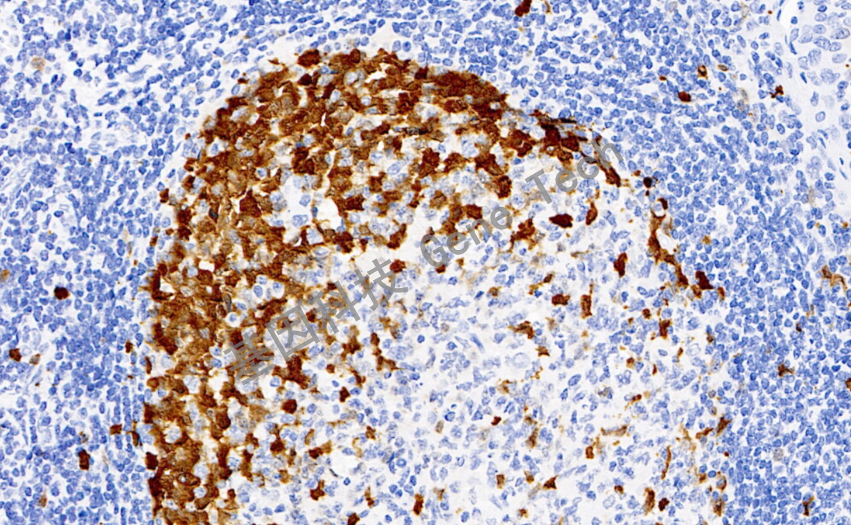 1681796533122203.jpg TS 20倍 细胞浆 扁桃体_副本.jpg