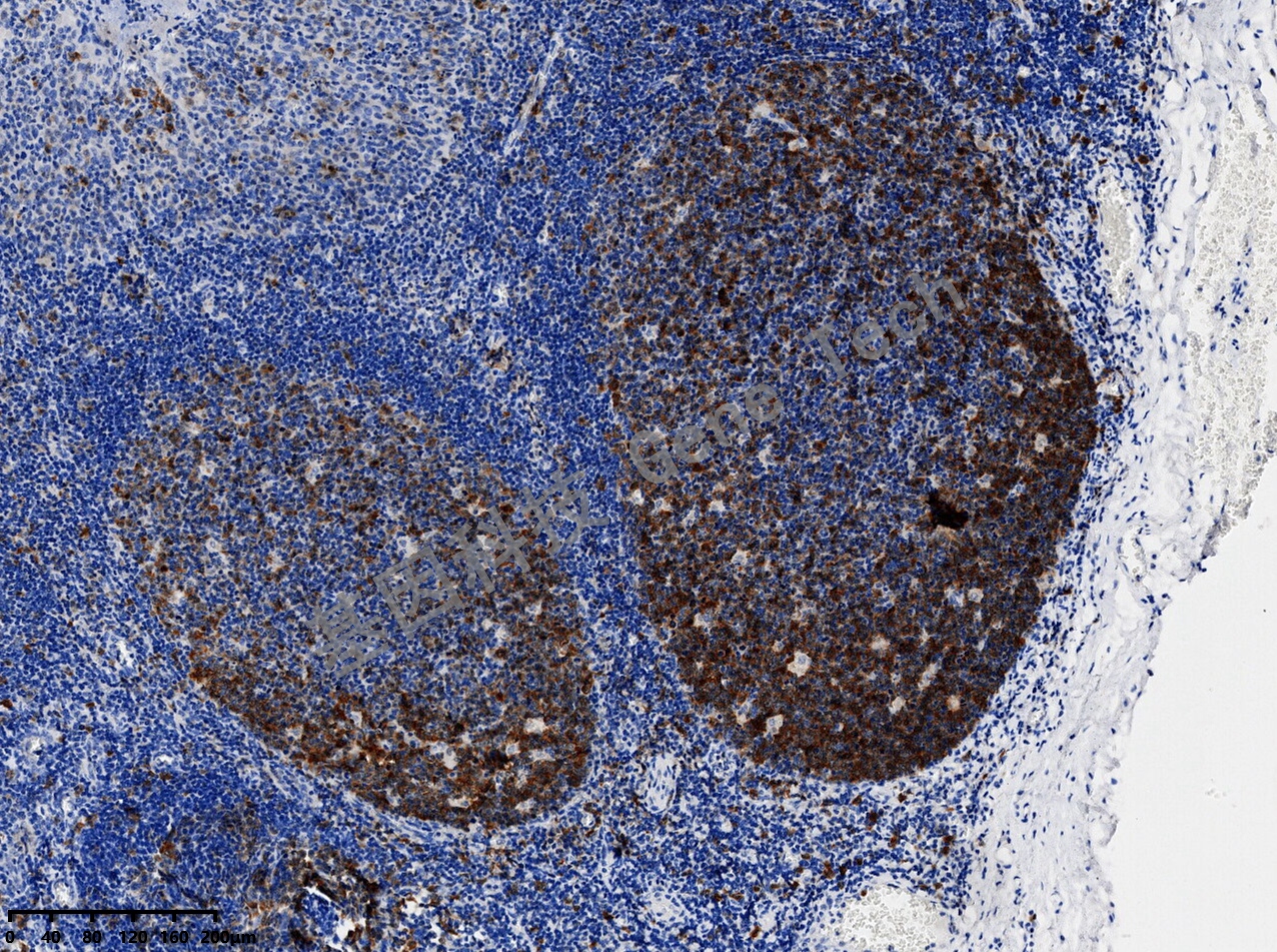 1681796538153195.jpg TS 扁桃体 20210108-24 W58_副本.jpg