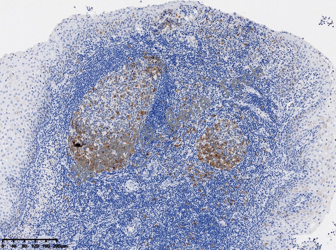 1681796542409381.jpg TS 扁桃体 20210108-25_副本.jpg