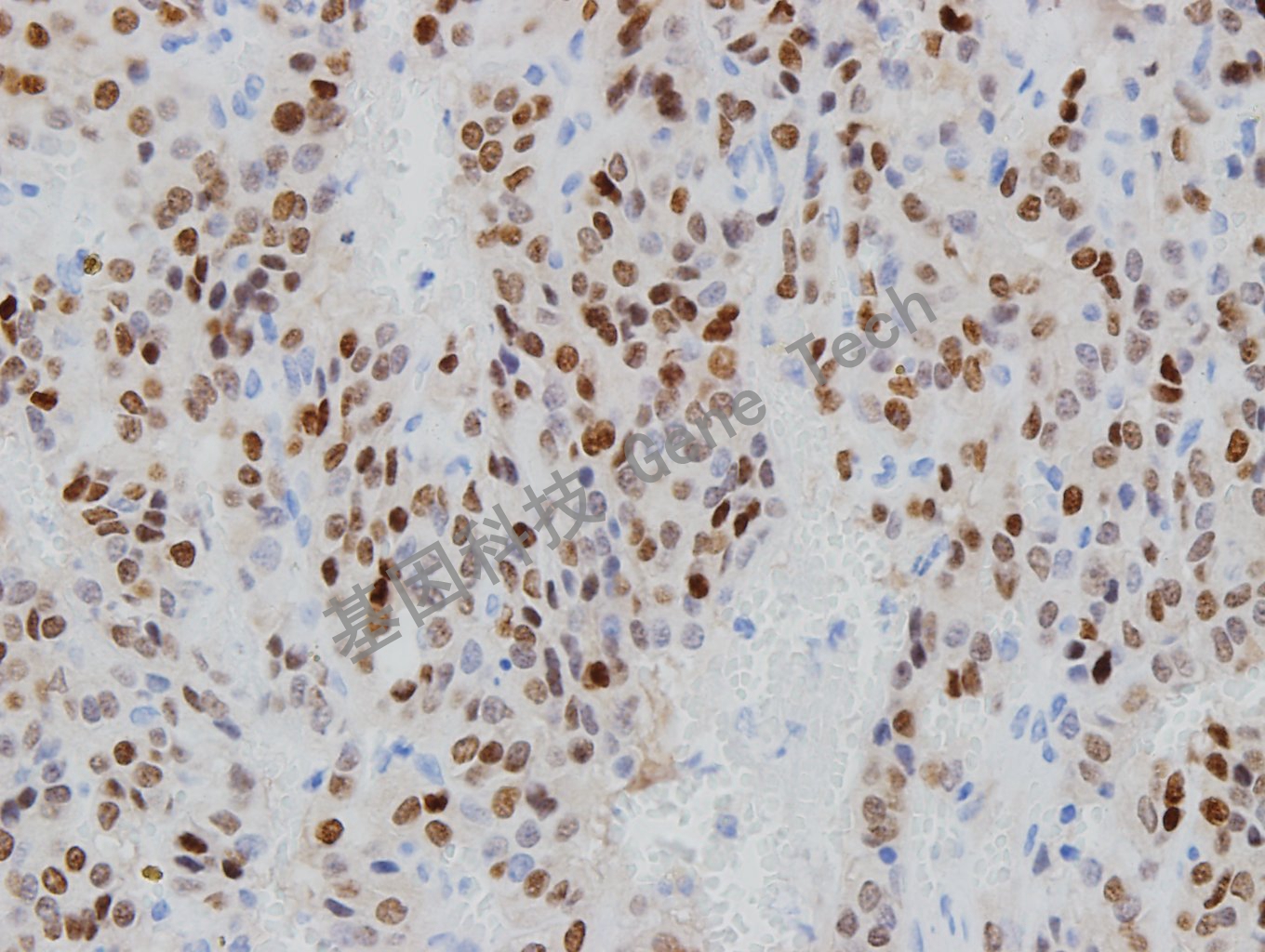 1681797048885661.jpg 20181204-14 NP1801206-6_副本.jpg