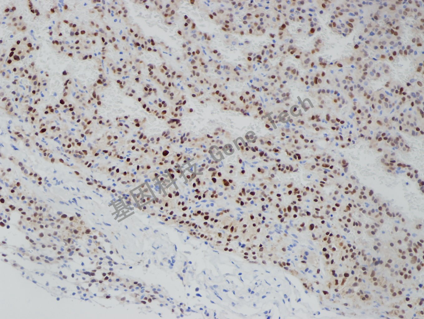 1681797080102522.jpg 20181204-14 NP1801206-2_副本.jpg