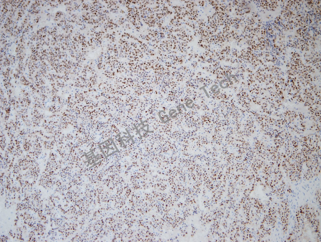 1681797092206783.jpg 20181204-14 NP1801206-1_副本.jpg