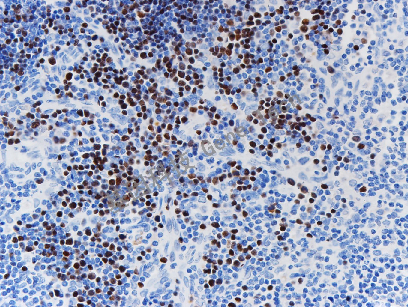 TDT   GT2025 胸腺 40x 20191021-9_副本.jpg