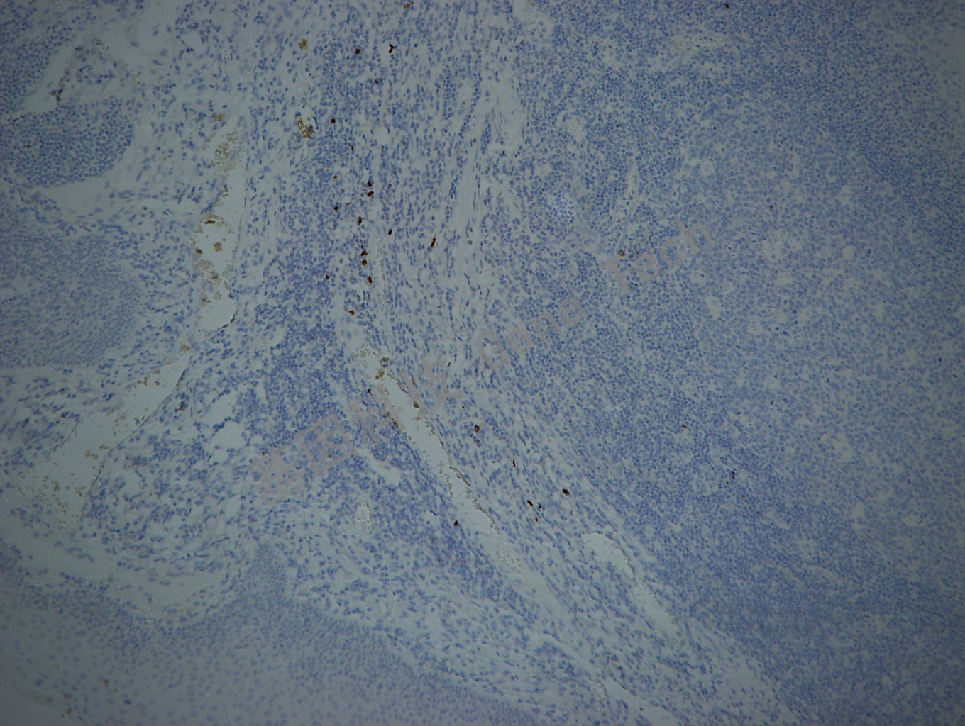 TDT 10X 扁桃体_副本.jpg