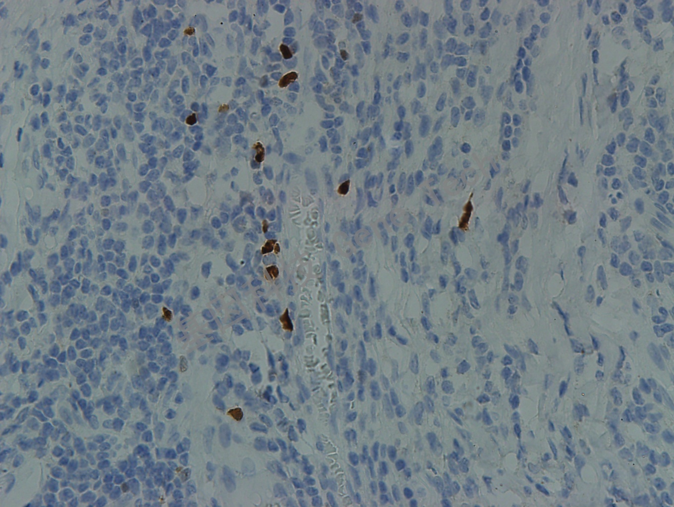 TDT 40X 扁桃体_副本.jpg