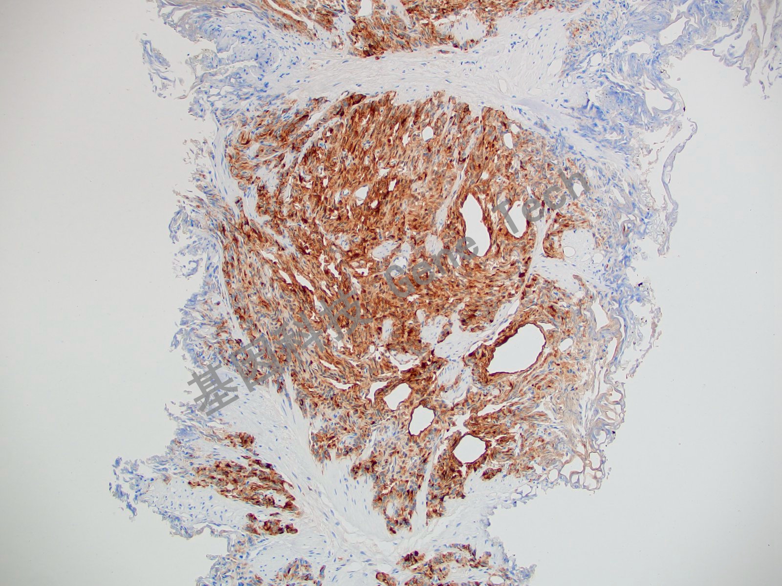 20210510-8 Survivin J12-2_副本.jpg