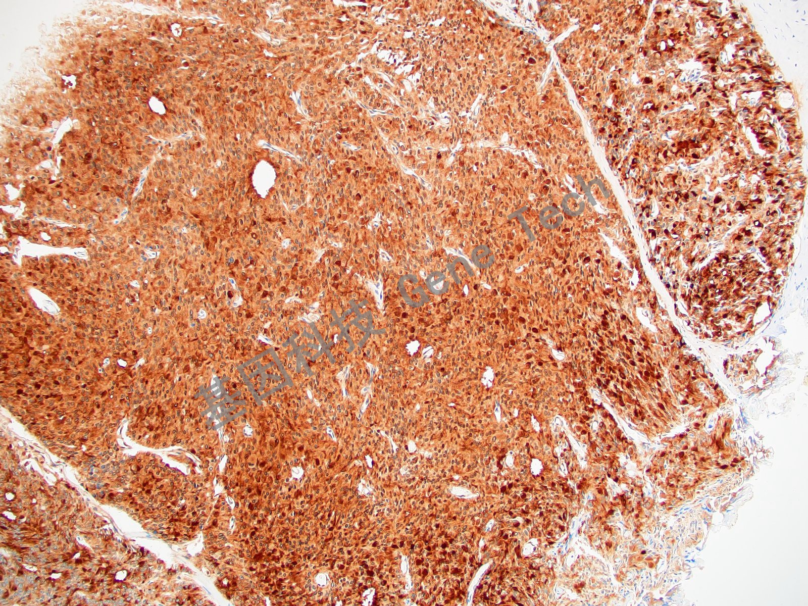 20210510-8 Survivin J12-3_副本.jpg