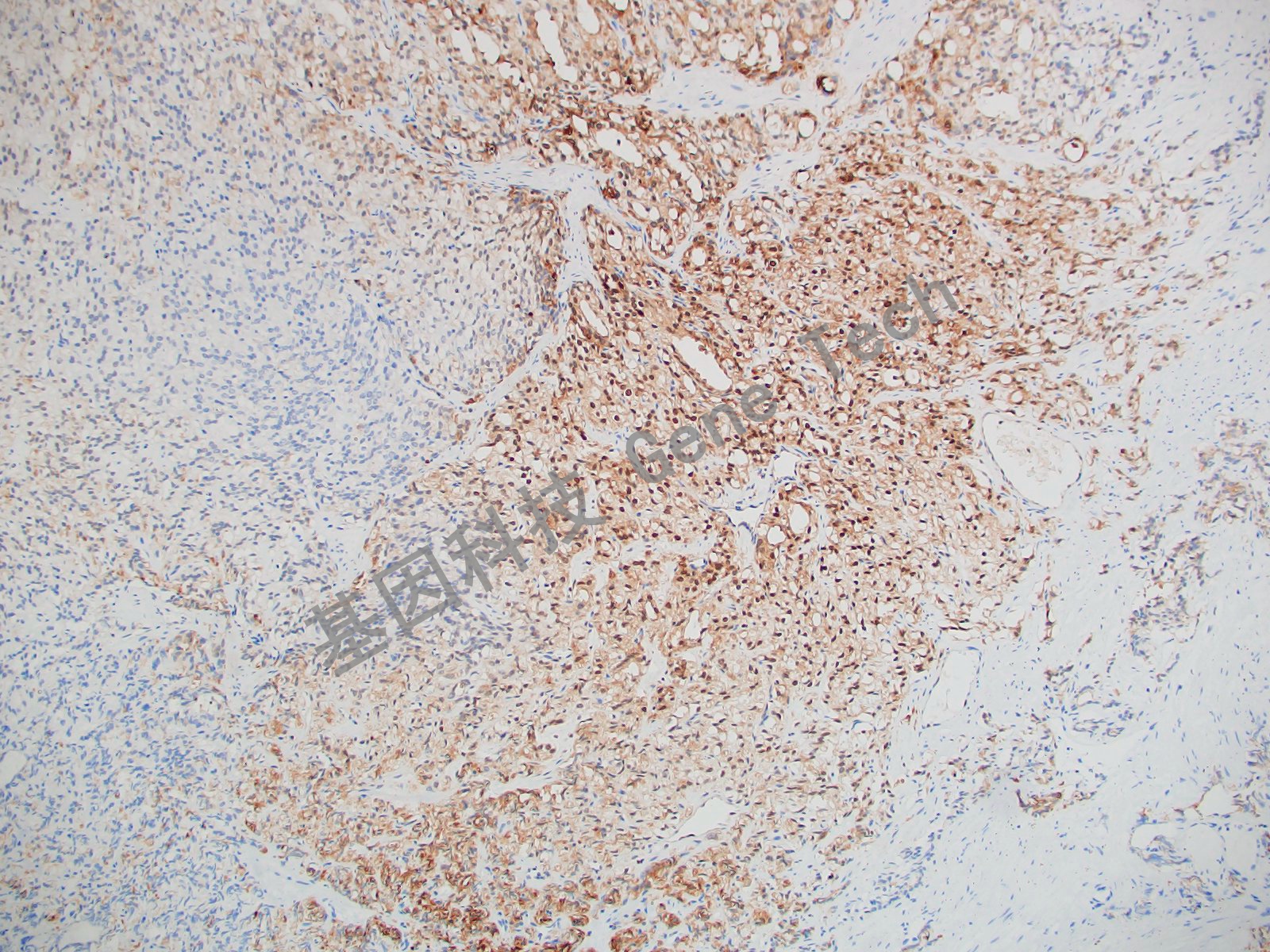 20210510-9 Survivin J14-2_副本.jpg