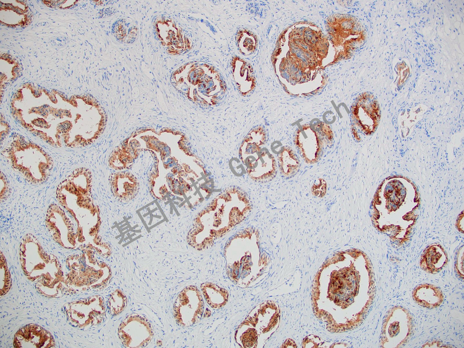 20210510-10 Survivin J18_副本.jpg