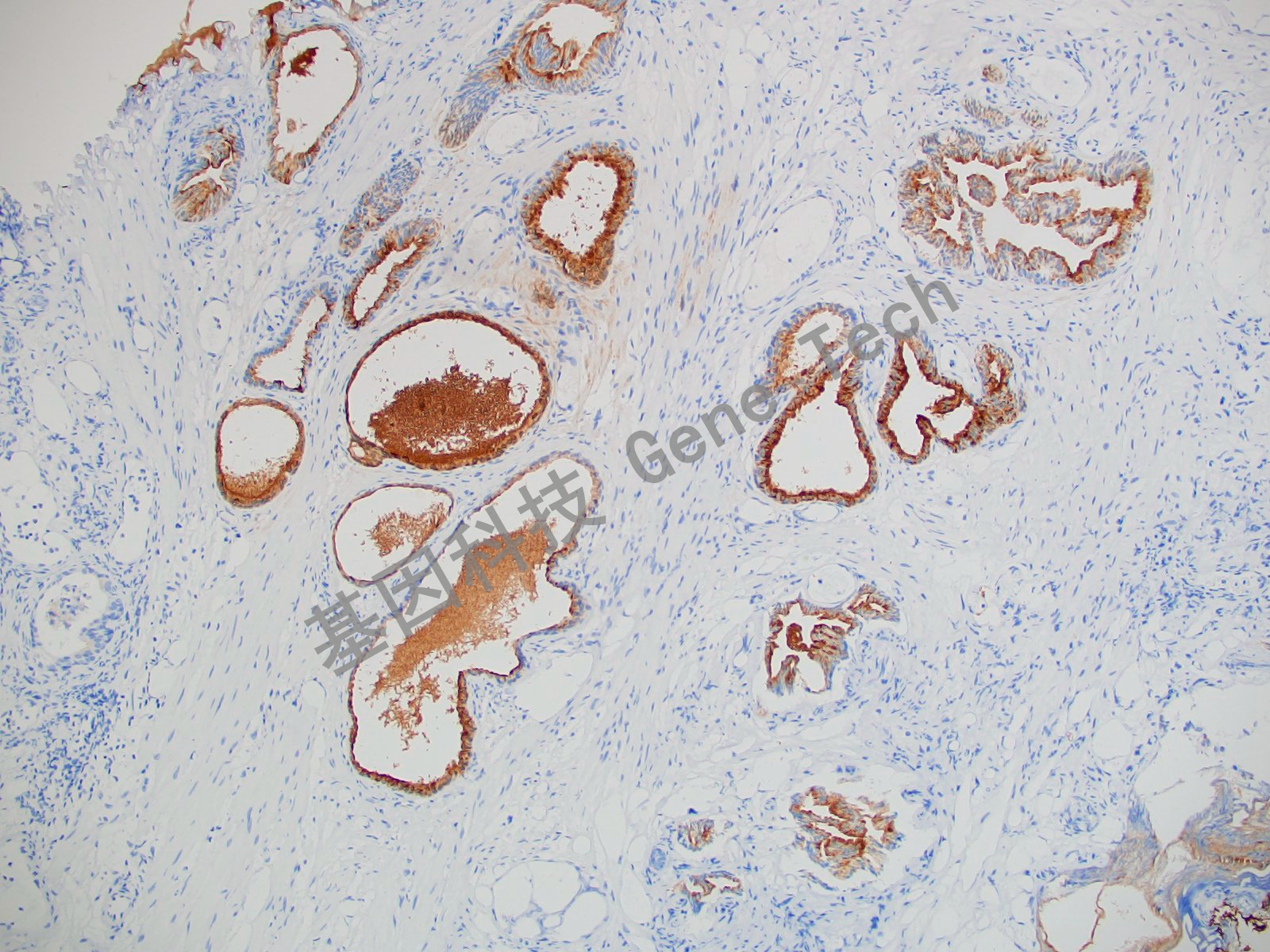 20210510-11 Survivin J22_副本.jpg