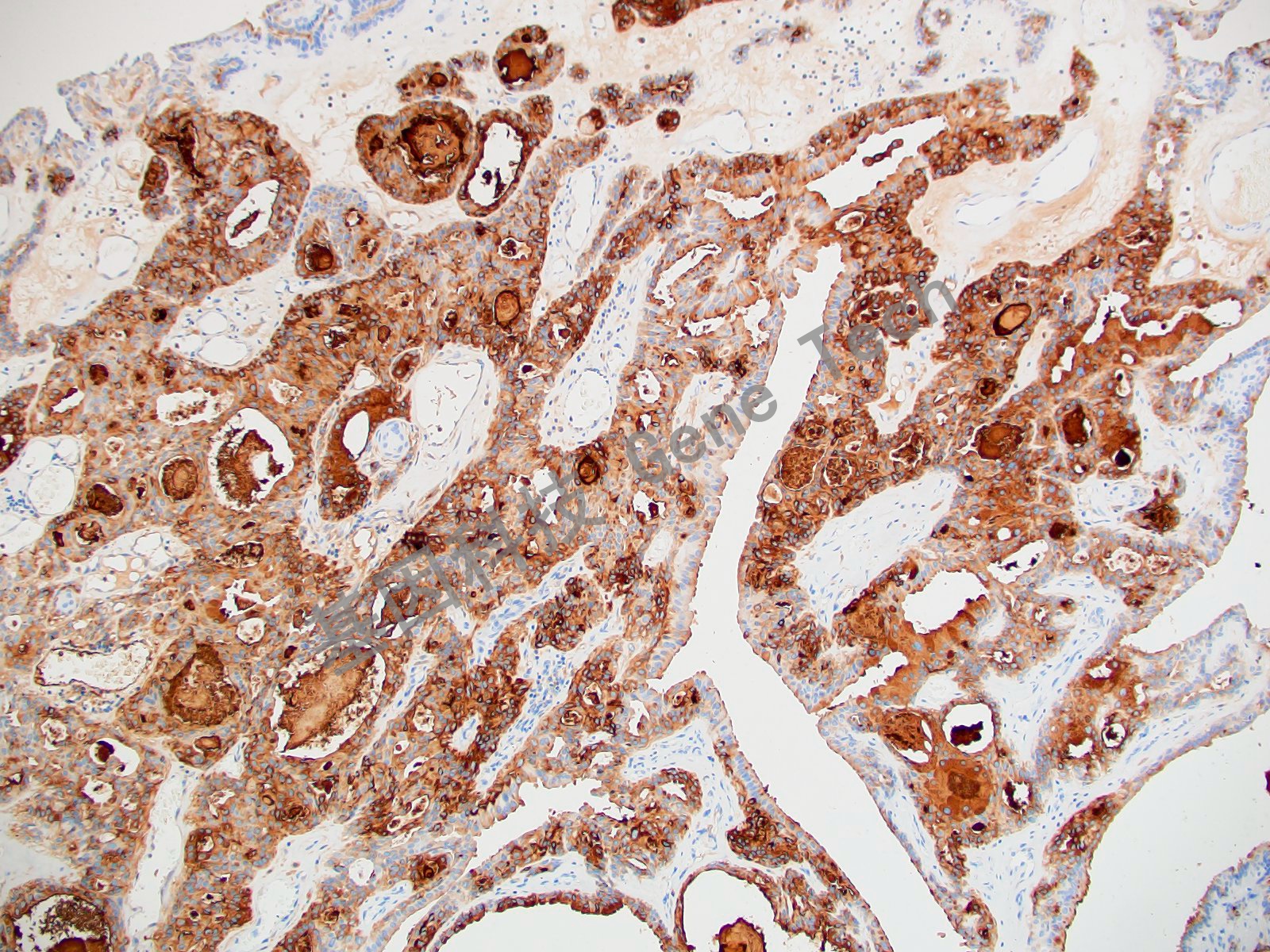 20210510-14 Survivin C70_副本.jpg