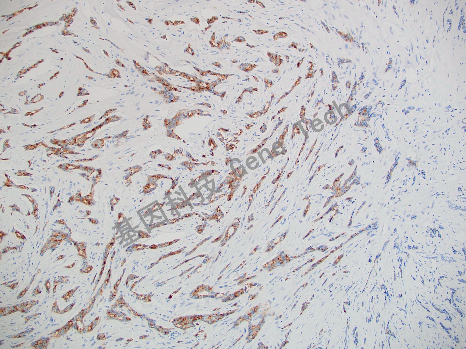 20210510-16 Survivin C78_副本.jpg