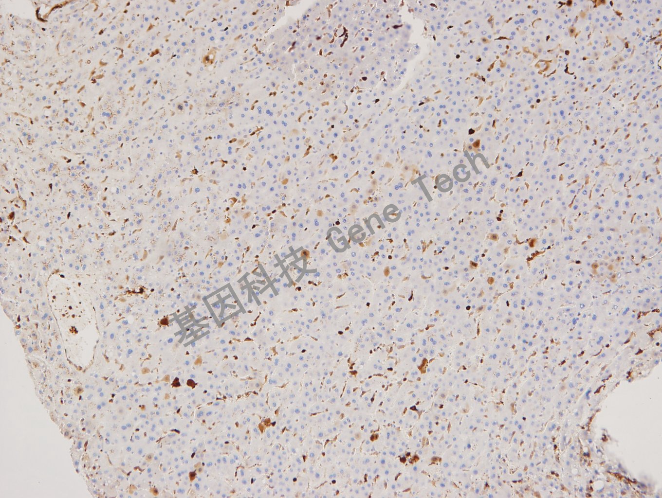 20180116-10 07-T19 肝_副本.jpg