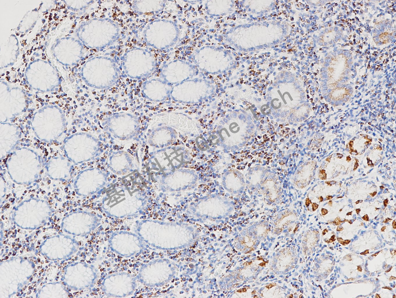 20171219-13 胃-2_副本.jpg