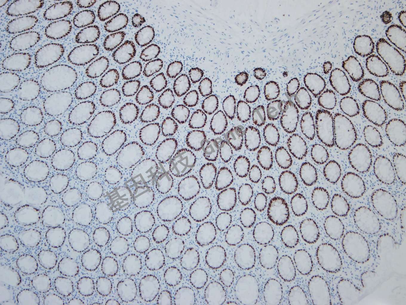 20190927-15 SOX9 F34 正常结肠-2_副本.jpg