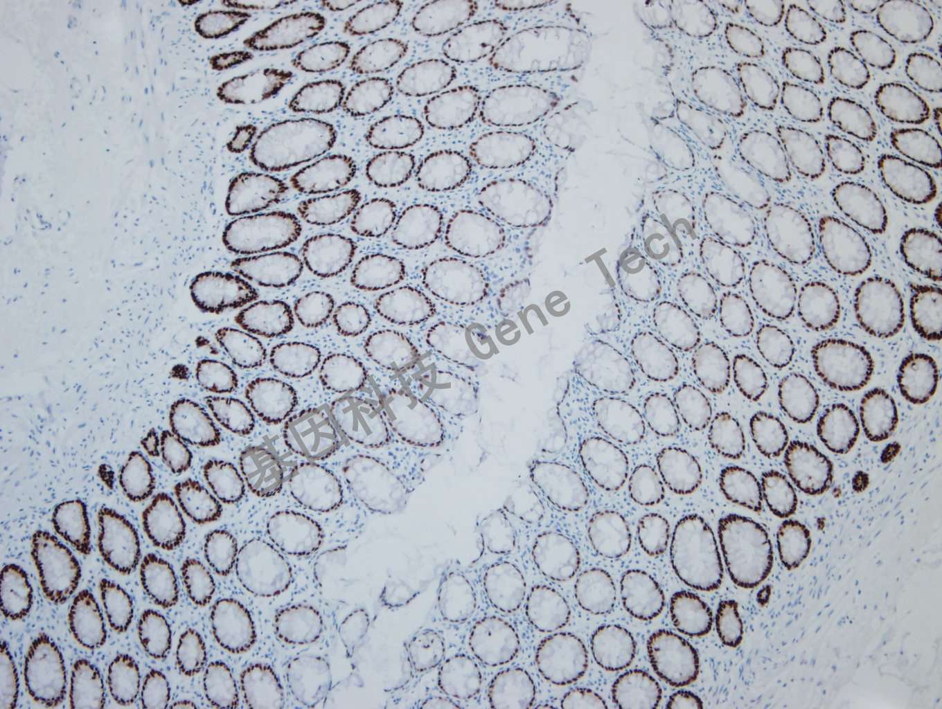 20190927-15 SOX9 F34 正常结肠-5_副本.jpg