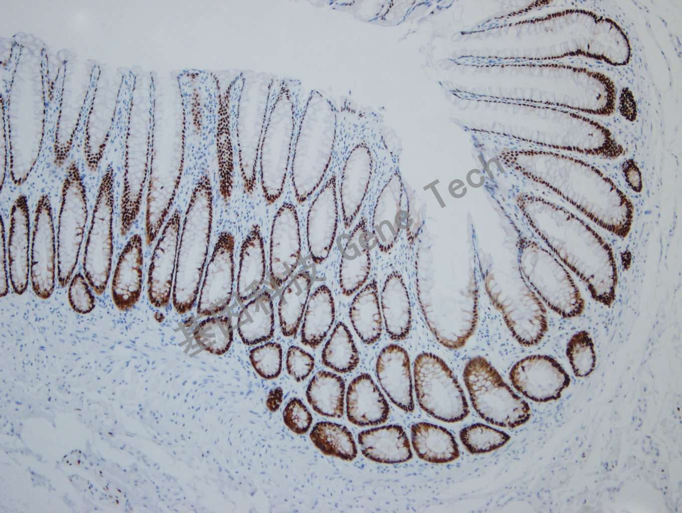 20190927-15 SOX9 F34 正常结肠-6_副本.jpg