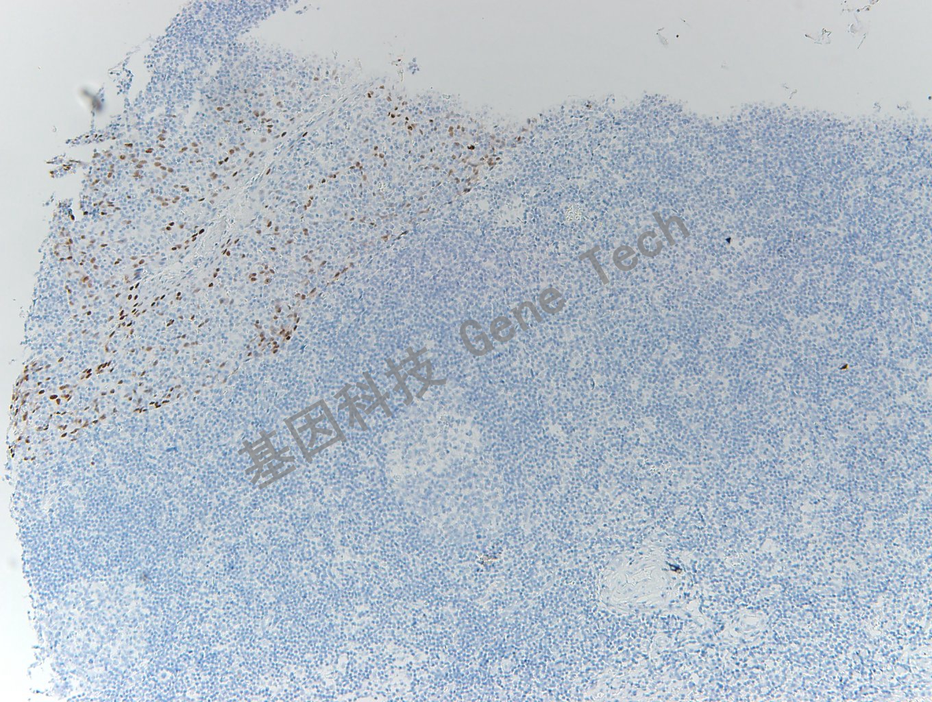 20200416-21 SOX-2 05-T6 扁桃体_副本.jpg