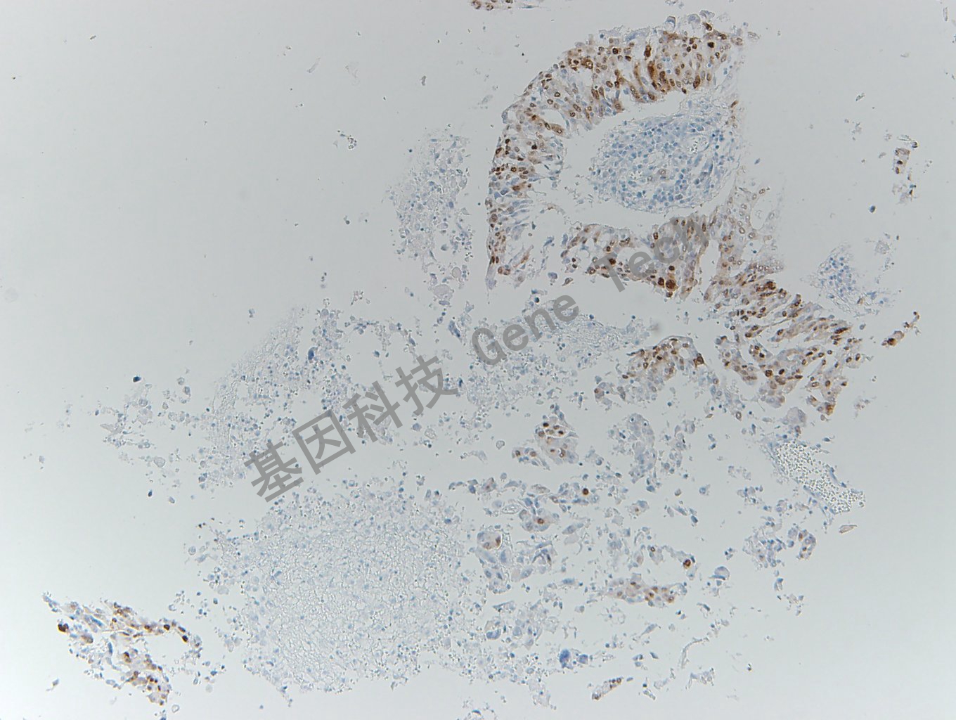 20200416-21 SOX-2 05-T6 肺1_副本.jpg