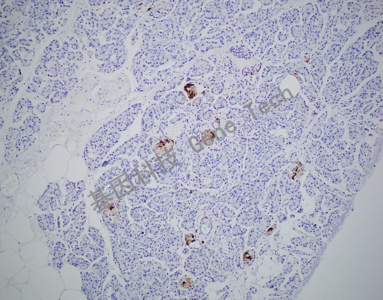20200118-2 Somatostatin H20_副本.jpg