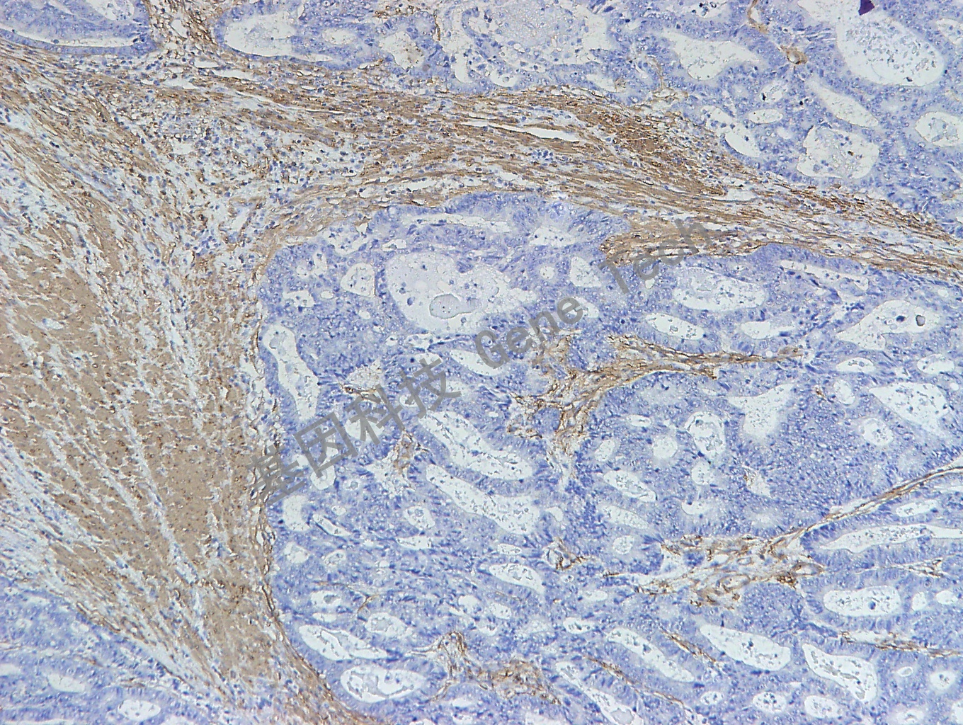 SMA GM0851 结肠1_副本.jpg