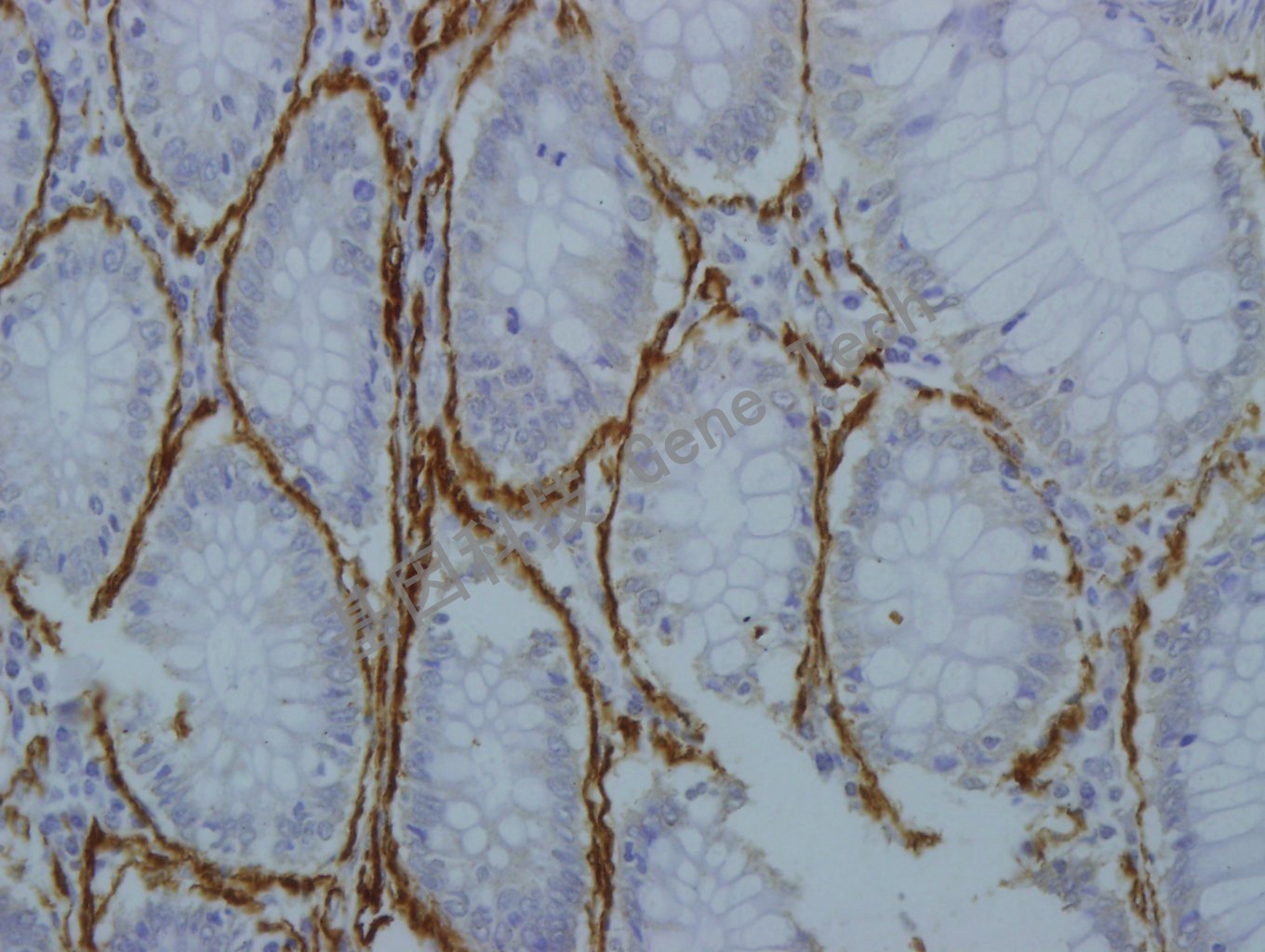 SMA GM0851 结肠3-40_副本.jpg