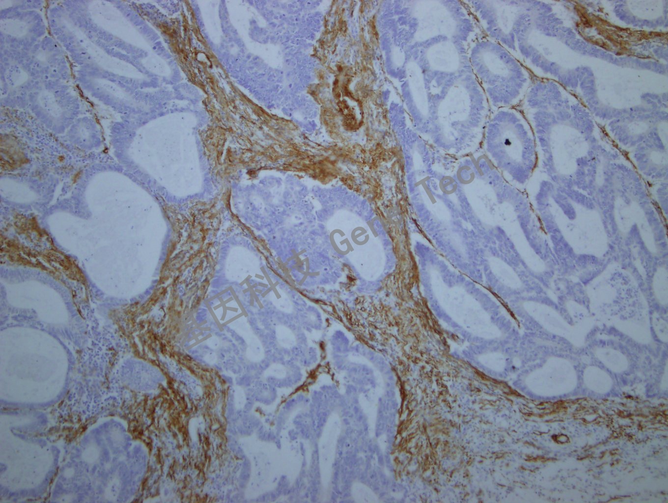 SMA GM0851 结肠-10_副本.jpg