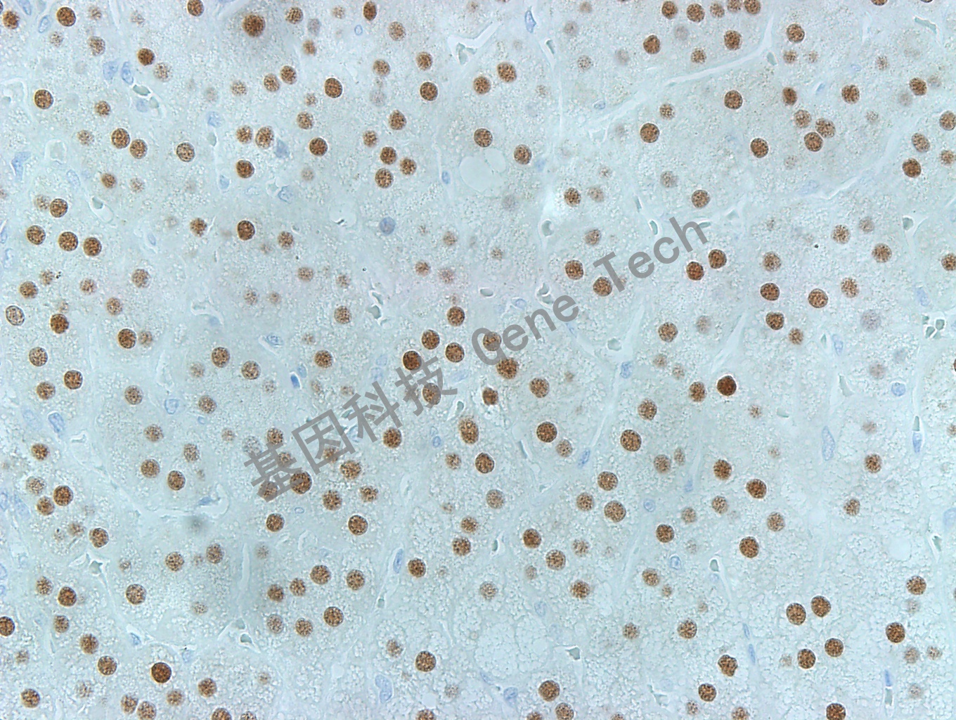 SF-1 肾上腺嗜铬细胞瘤40X_副本.jpg