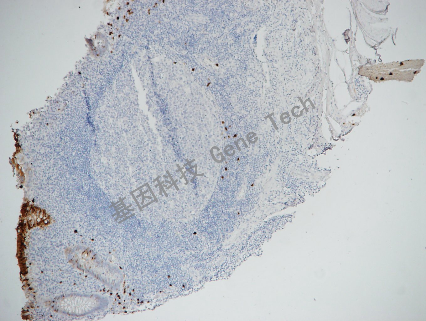 S100p GT2286-阑尾_副本.jpg