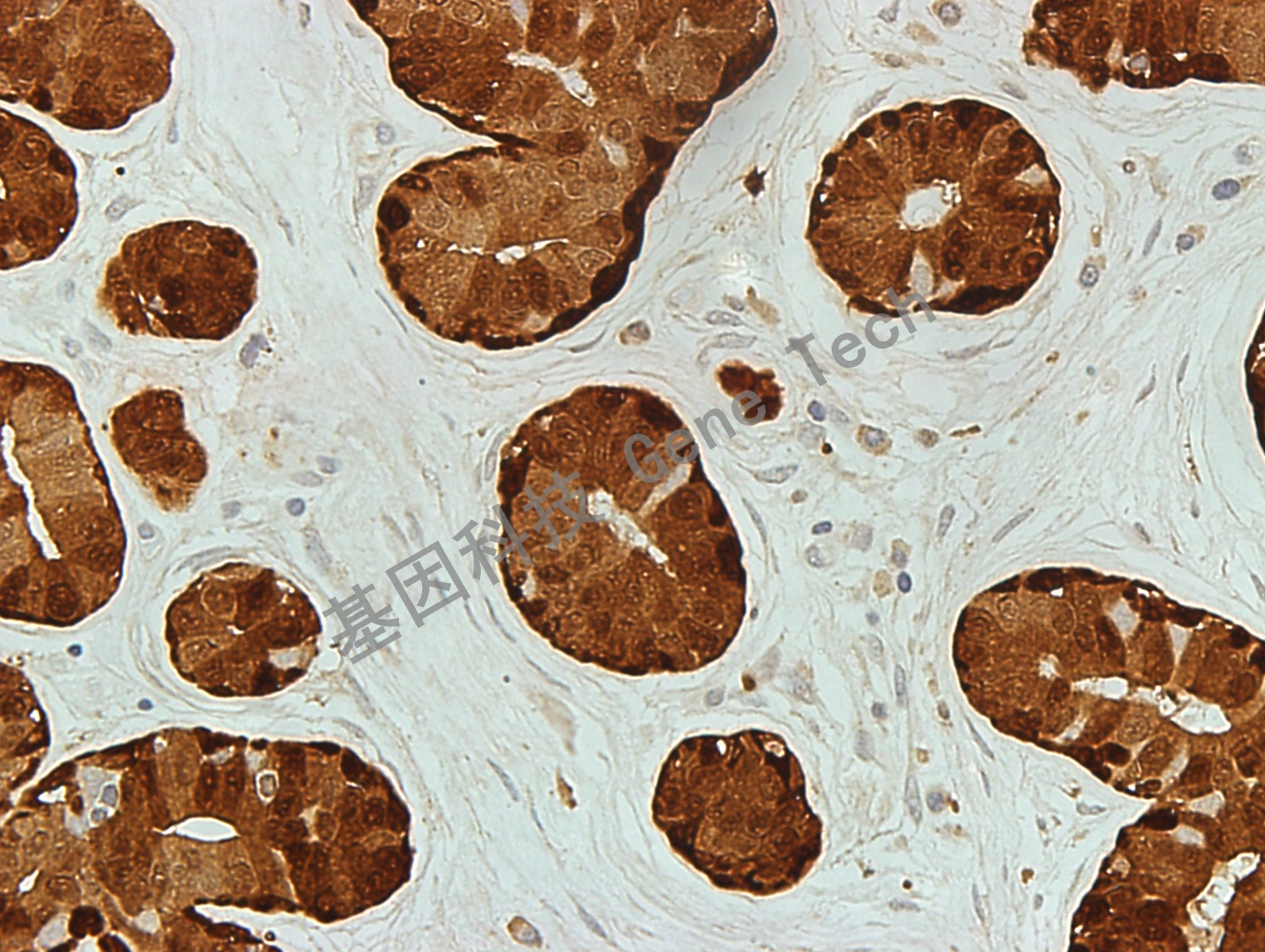 S100-3(Breast hyperplasia)-400_副本.jpg