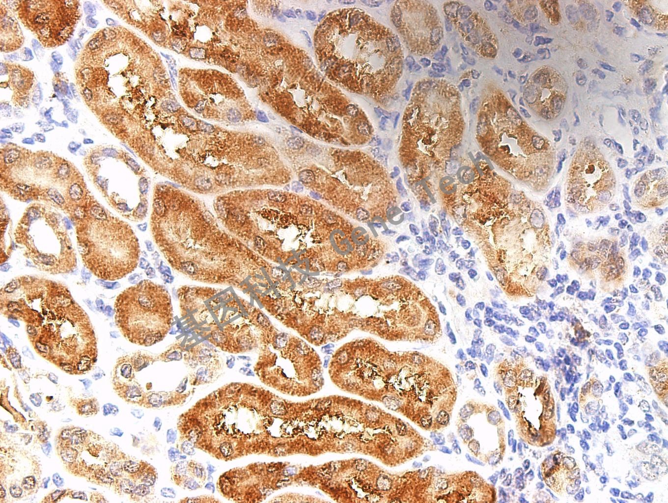 1681799711227016.jpg RRM1 40X RCC_副本.jpg