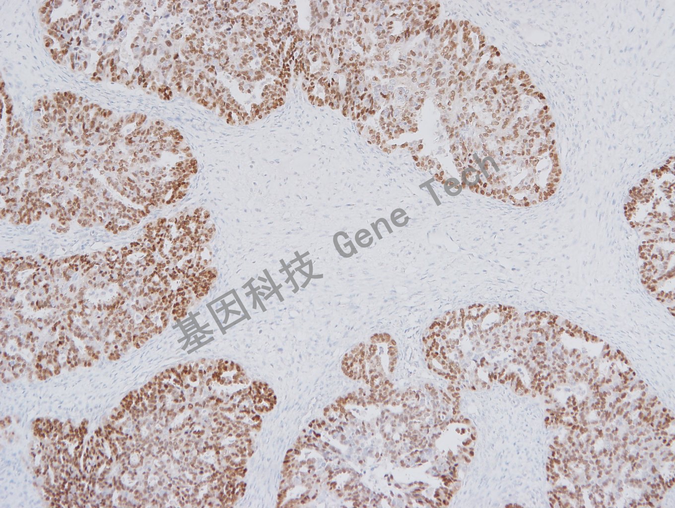 1682665752191796.jpg 20180105-11 卵巢_副本.jpg