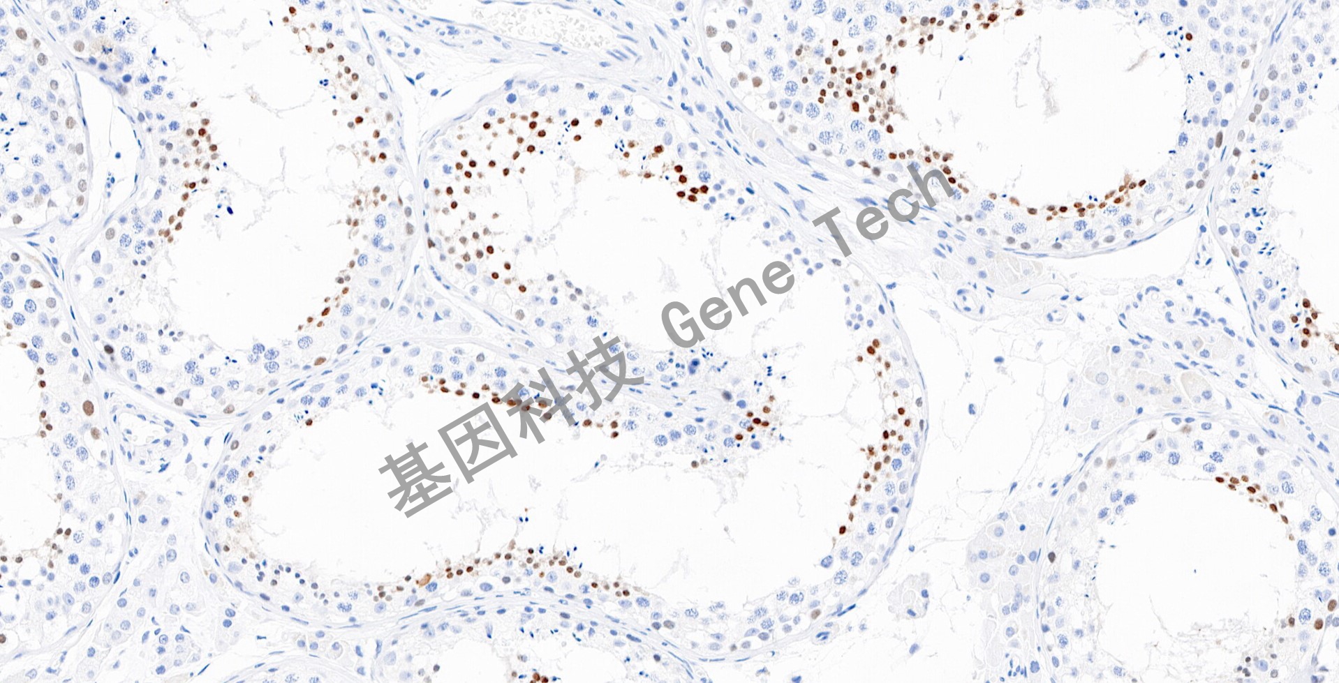 20230331-14-NUT-WGT2432-BY11_20x 睾丸_1_副本.jpg