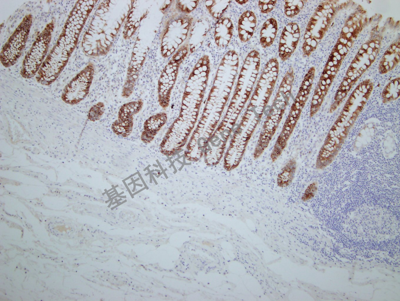 MUC-4 GT2275 结肠-10X_副本.jpg