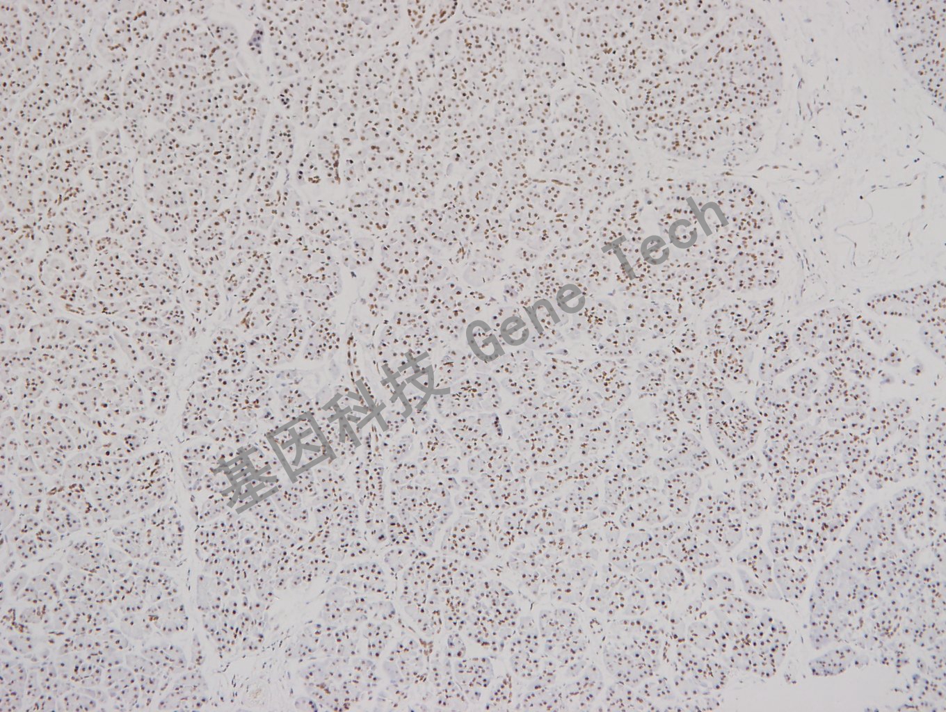 1683531714773101.jpg 20180103-15 07-T19 胰腺_副本.jpg