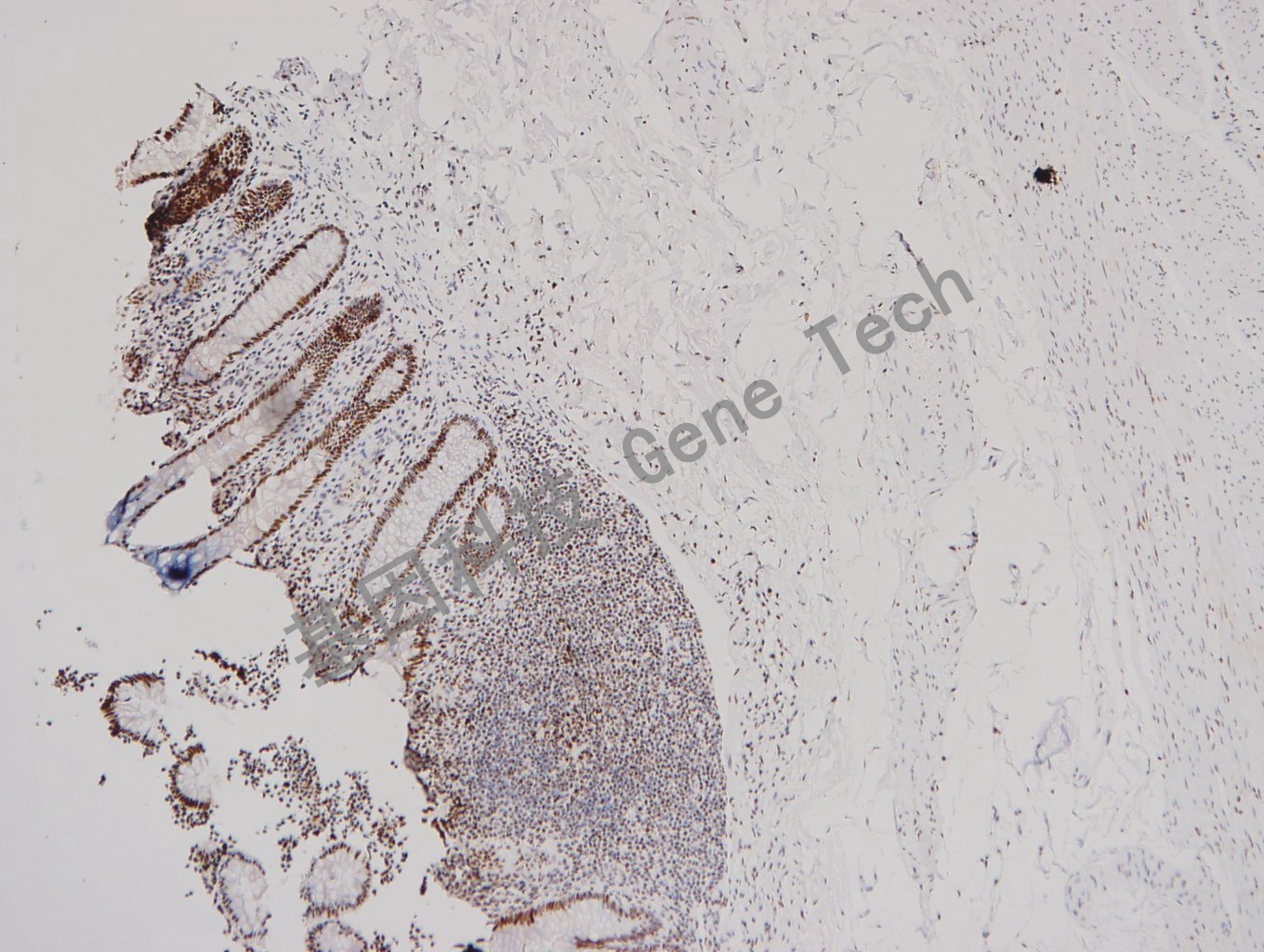 1683531719890079.jpg 20180103-15 07-T19 阑尾_副本.jpg