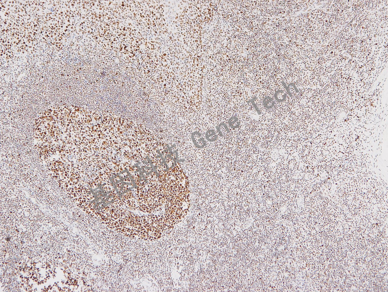 1683531727146304.jpg 20180103-15 07-T19 扁桃体_副本.jpg